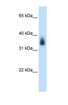 Western Blot: MAGEA8 Antibody [NBP1-55465]