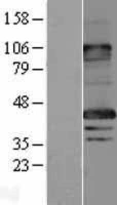 Western Blot: MAGEA8 Overexpression Lysate [NBL1-12805]