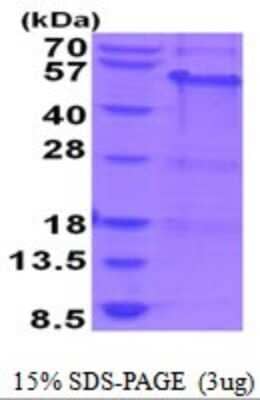 SDS-PAGE: Recombinant Human MAGEA8 His Protein [NBP2-52055]