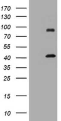 Western Blot: MAGEA9 Antibody (OTI1D8) [NBP2-45800]