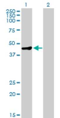 Western Blot: MAGEA9 Antibody [H00004108-B01P]