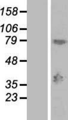 Western Blot: MAGEA9 Overexpression Lysate [NBL1-12806]