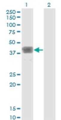 Western Blot: MAGEB1 Antibody (2A4) [H00004112-M01]