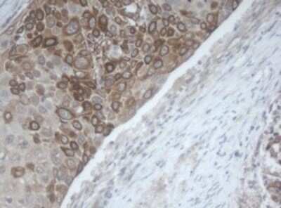 Immunohistochemistry: MAGEB1 Antibody (OTI4E12) [NBP2-45801]