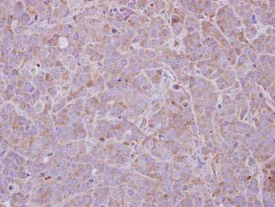 Immunohistochemistry-Paraffin: MAGEB1 Antibody [NBP1-32231]