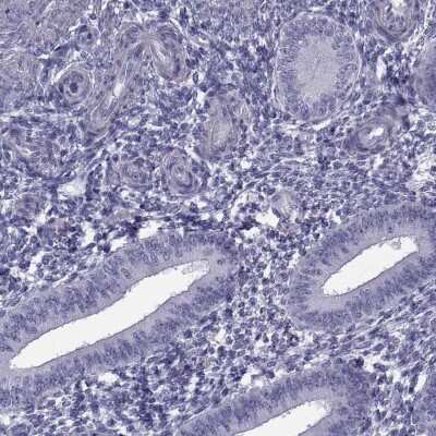 Immunohistochemistry-Paraffin: MAGEB1 Antibody [NBP1-85405]