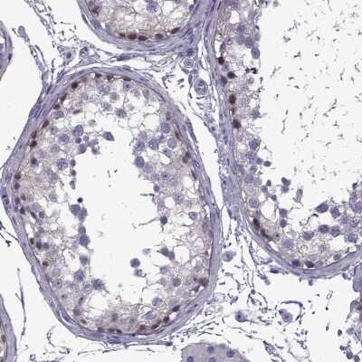 Immunohistochemistry-Paraffin: MAGEB1 Antibody [NBP1-85405]