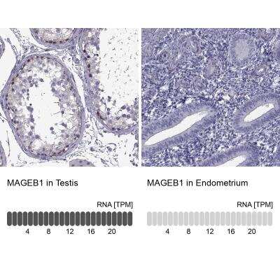 Immunohistochemistry-Paraffin: MAGEB1 Antibody [NBP1-85405]