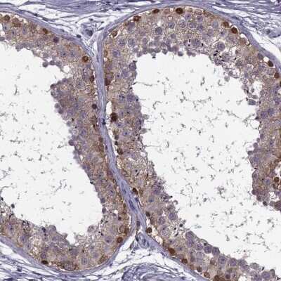 Immunohistochemistry-Paraffin: MAGEB1 Antibody [NBP1-85406]