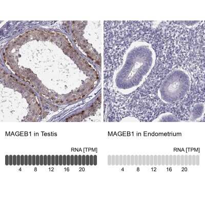 Immunohistochemistry-Paraffin: MAGEB1 Antibody [NBP1-85406]