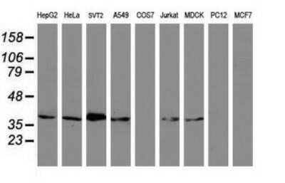 Western Blot: MAGEB1 Antibody (OTI4E12)Azide and BSA Free [NBP2-72573]