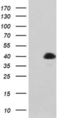 Western Blot: MAGEB1 Antibody (OTI4E12)Azide and BSA Free [NBP2-72573]