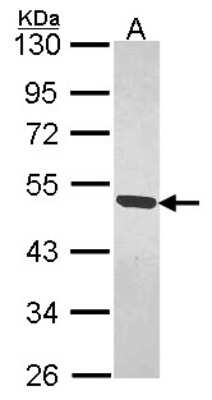 Western Blot: MAGEB1 Antibody [NBP1-32231]