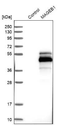 Western Blot: MAGEB1 Antibody [NBP1-85406]