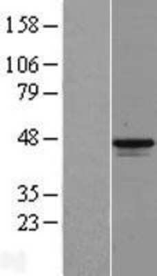 Western Blot: MAGEB1 Overexpression Lysate [NBP2-09783]