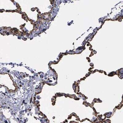 Immunohistochemistry-Paraffin: MAGEB10 Antibody [NBP1-81983]