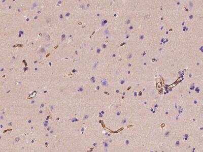 Immunohistochemistry-Paraffin: MAGEB10 Antibody [NBP3-06050]