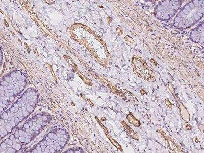 Immunohistochemistry-Paraffin: MAGEB10 Antibody [NBP3-06050]