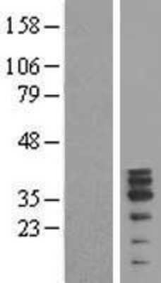 Western Blot: MAGEB10 Overexpression Lysate [NBP2-04861]