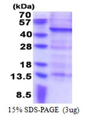 SDS-PAGE: Recombinant Human MAGEB10 His Protein [NBP2-23225]