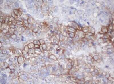 Immunohistochemistry: MAGEB18 Antibody (OTI1H2) [NBP2-45721]