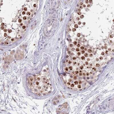 Immunohistochemistry-Paraffin: MAGEB18 Antibody [NBP2-14211]