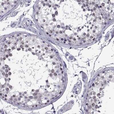 Immunohistochemistry-Paraffin: MAGEB18 Antibody [NBP2-14211]