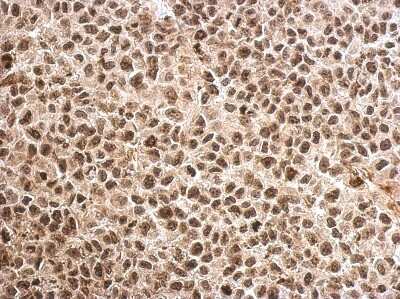 Immunohistochemistry-Paraffin: MAGEB18 Antibody [NBP2-17206]