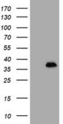 Western Blot: MAGEB18 Antibody (OTI1F5)Azide and BSA Free [NBP2-72575]