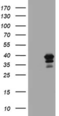 Western Blot: MAGEB18 Antibody (OTI1H2)Azide and BSA Free [NBP2-72577]