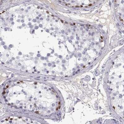 Immunohistochemistry-Paraffin: MAGEB2 Antibody [NBP2-62688]