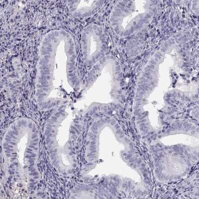 Immunohistochemistry-Paraffin: MAGEB2 Antibody [NBP2-62688]