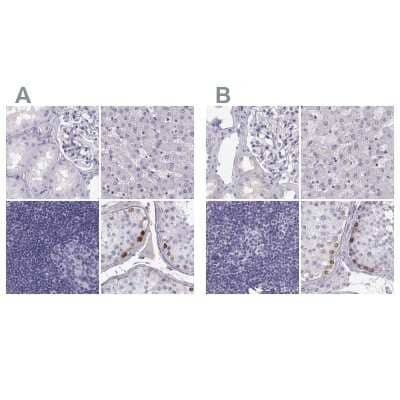 Immunohistochemistry-Paraffin: MAGEB2 Antibody [NBP2-62688]