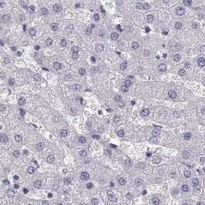 Immunohistochemistry-Paraffin: MAGEB2 Antibody [NBP2-62688]
