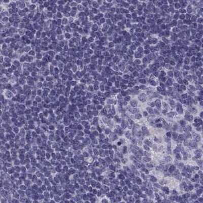 Immunohistochemistry-Paraffin: MAGEB2 Antibody [NBP2-62688]
