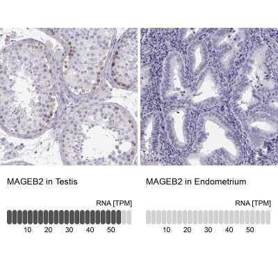 Immunohistochemistry-Paraffin: MAGEB2 Antibody [NBP2-62697]