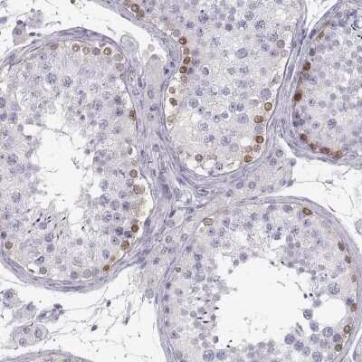 Immunohistochemistry-Paraffin: MAGEB2 Antibody [NBP2-62697]
