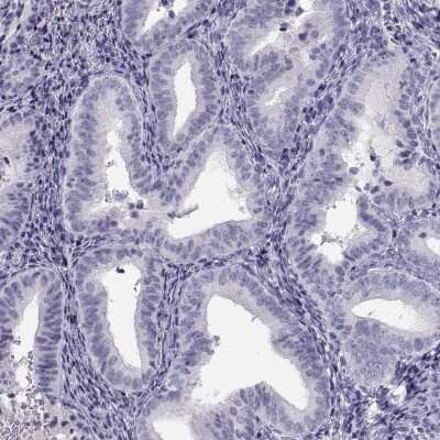 Immunohistochemistry-Paraffin: MAGEB2 Antibody [NBP2-62697]