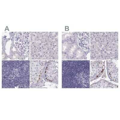 Immunohistochemistry-Paraffin: MAGEB2 Antibody [NBP2-62697]