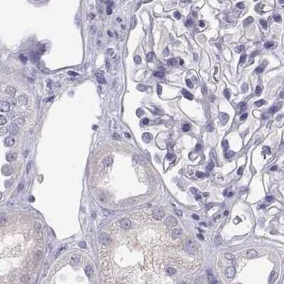 Immunohistochemistry-Paraffin: MAGEB2 Antibody [NBP2-62697]