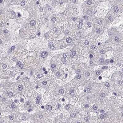 Immunohistochemistry-Paraffin: MAGEB2 Antibody [NBP2-62697]