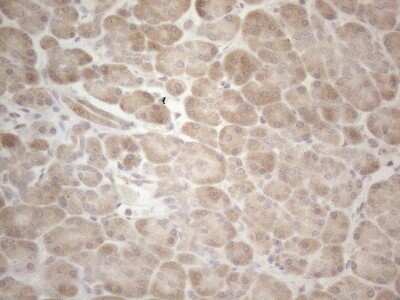 Immunohistochemistry: MAGEB3 Antibody (OTI5H8) [NBP2-45722]