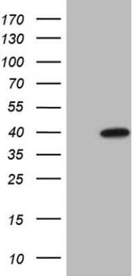 Western Blot: MAGEB3 Antibody (OTI5H8) [NBP2-45722]