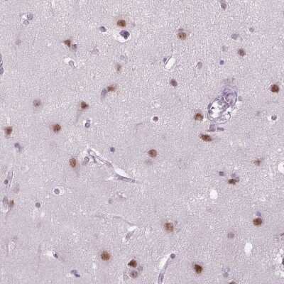 Immunohistochemistry-Paraffin: MAGEB3 Antibody [NBP2-58828]