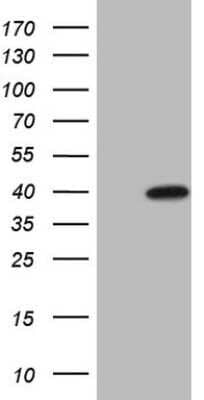 Western Blot: MAGEB3 Antibody (OTI5H8)Azide and BSA Free [NBP2-72579]