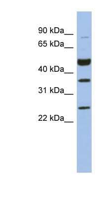 Western Blot: MAGEB3 Antibody [NBP1-56934]