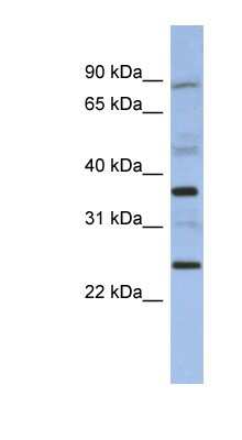 Western Blot: MAGEB3 Antibody [NBP1-57659]