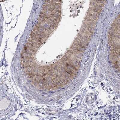 Immunohistochemistry-Paraffin: MAGEB4 Antibody [NBP1-85404]