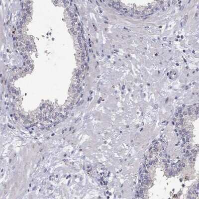 Immunohistochemistry-Paraffin: MAGEB4 Antibody [NBP1-85404]
