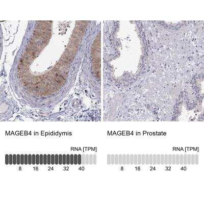 Immunohistochemistry-Paraffin: MAGEB4 Antibody [NBP1-85404]